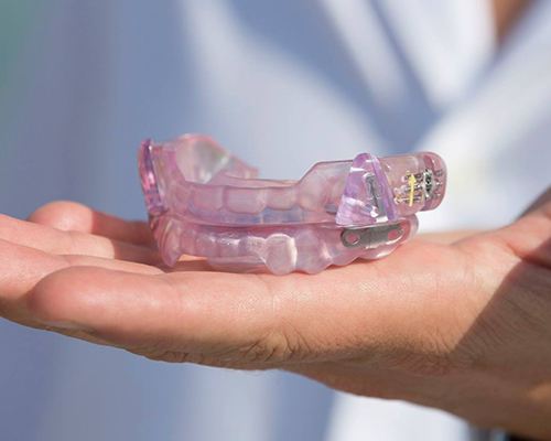 pink oral appliance