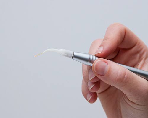 Hand holding dental laser, preparing for frenectomy procedure