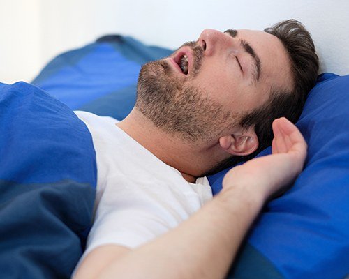 man laying under blue sheet with mouth wide open