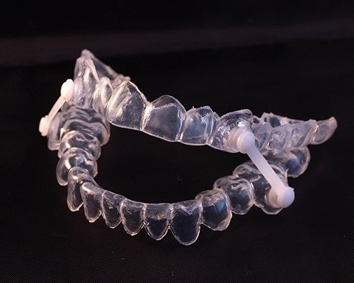 clear oral appliance