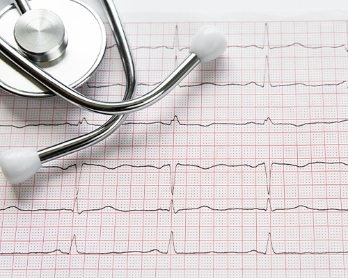 heartbeat chart