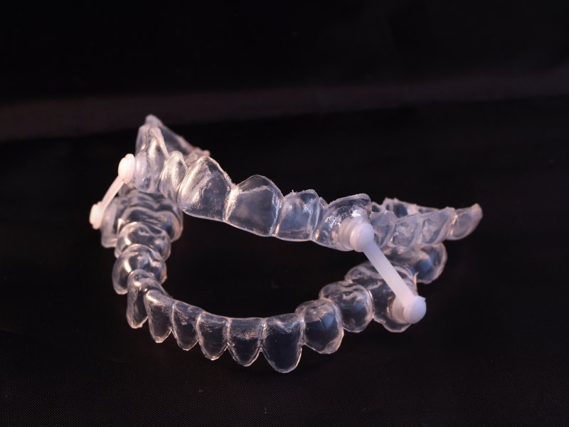 Oral appliance on black background